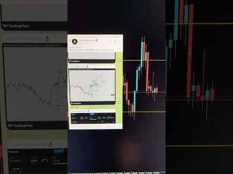 TFX! #daytrading #livetrading