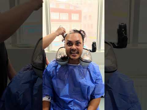 Shaving my head BALD so I can get a Hair Transplant in Istanbul Turkey 🇹🇷
