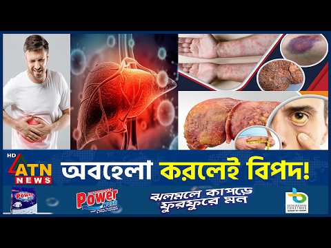 ত্বকের এই ৪টি সংকেত বলে দেবে আপনার লিভার কেমন আছে | Health Tips | Liver Disease | ATN News