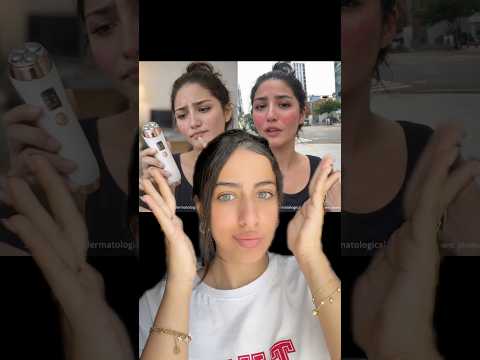 ليش خربوا وجهم؟