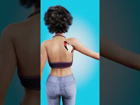 How To Relieve A Tight Neck 😌