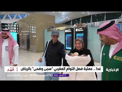 غدا.. عملية فصل التوأم الملتصق المغربي "سجى وضحى" في الرياض