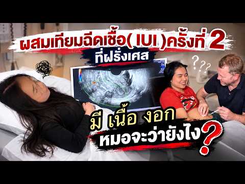 EP.2 นักล่า2ขีด🤰รักษาผู้บุตรยากที่ฝรั่งเศส🏥ทำ IUI รอบ 2 มีเนื้อ งอกที่มดลูก, จริงไหมรักษาฟรี? 