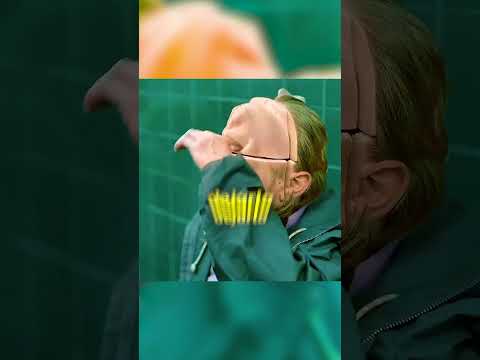 NO PUDO VOLVER A ARMAR SU PROPIA CABEZA