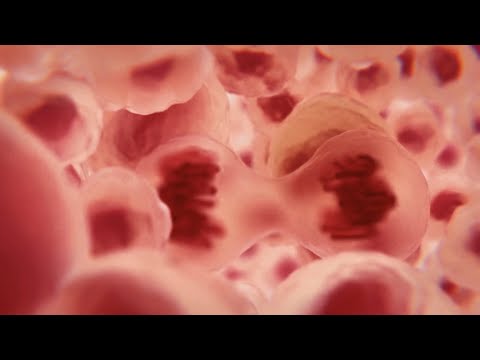 Kidney cancer سرطان الكلى ( أعراض و تشخيص و علاج سرطان الكلية )
