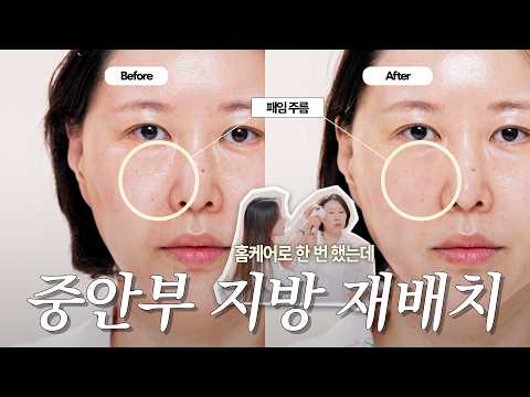 얼굴이 왜 자꾸 길어지지?😱 ‘중안부’ 때문입니다‼️ 집에서 줄이는 법